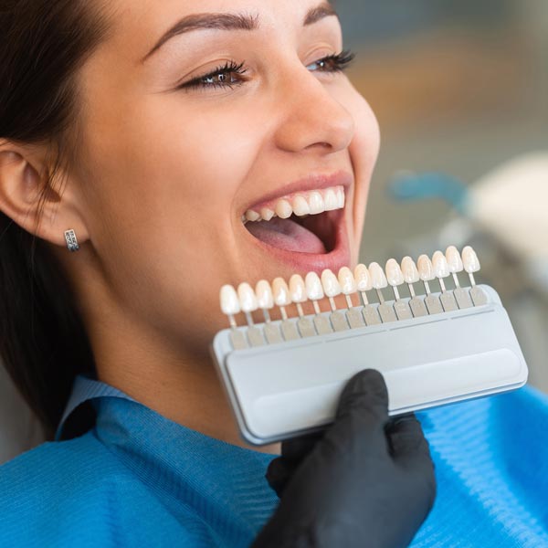 veneers being selected